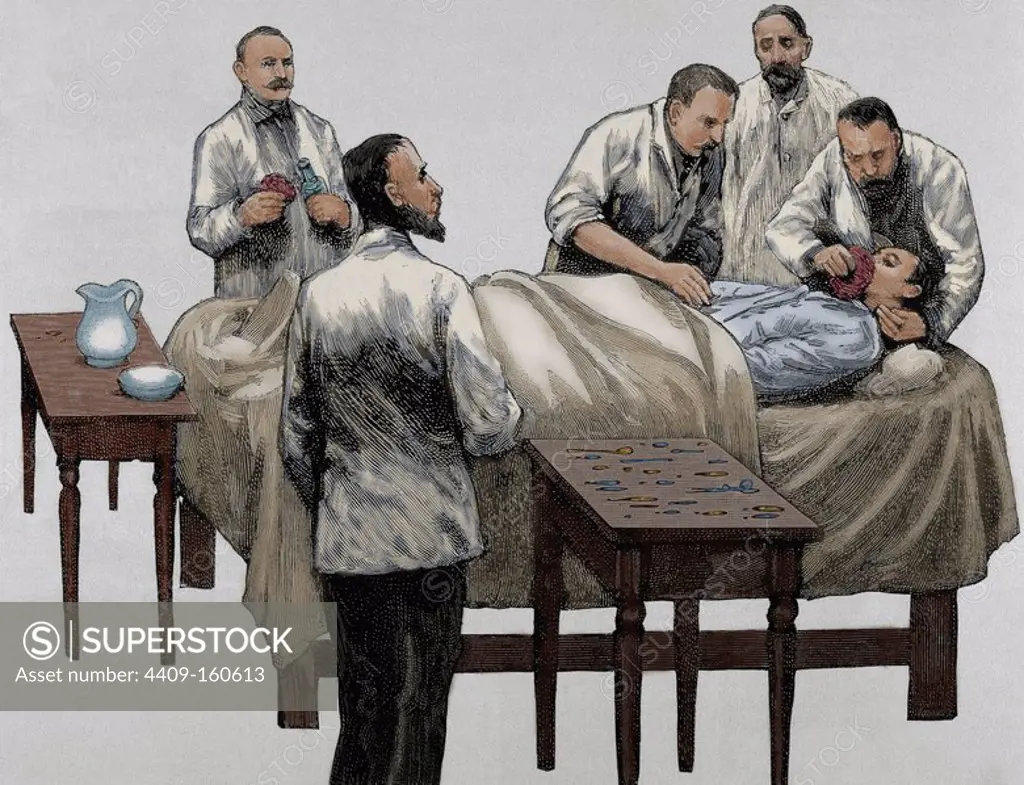 History of medicine. Chloroform anesthesia. Engraving, 19th century. Colored.