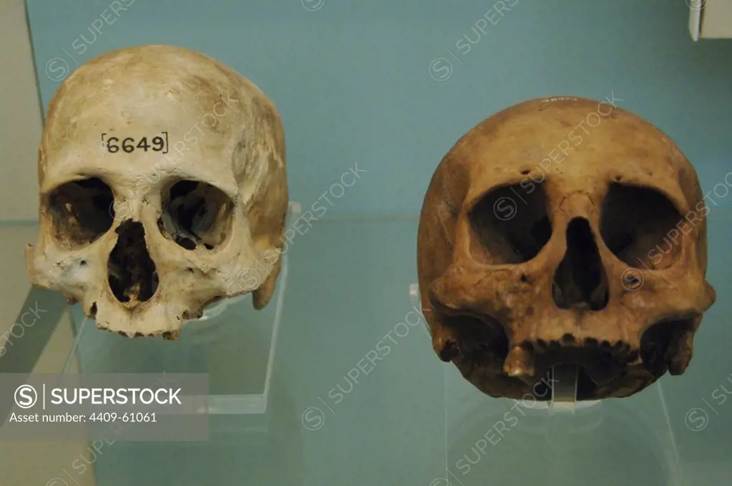 Egypt. Skulls. Initial Late Period. One of them is dated after 664 BC. 26th dynasty or Saite Period (672-525 BC). From cemetery near Tura. The other has uncertain date and unknown origin. British Museum. London. United Kingdom.