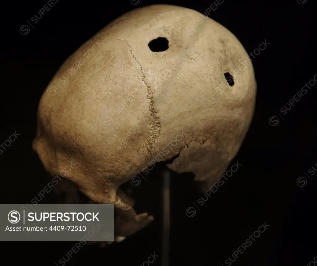 Trepanned skull of a man. 21-35 years old. 3500-3400 BC. From Dojringe Mose, Zealand. National Museum of Denmark. Copenhagen. Denmark.