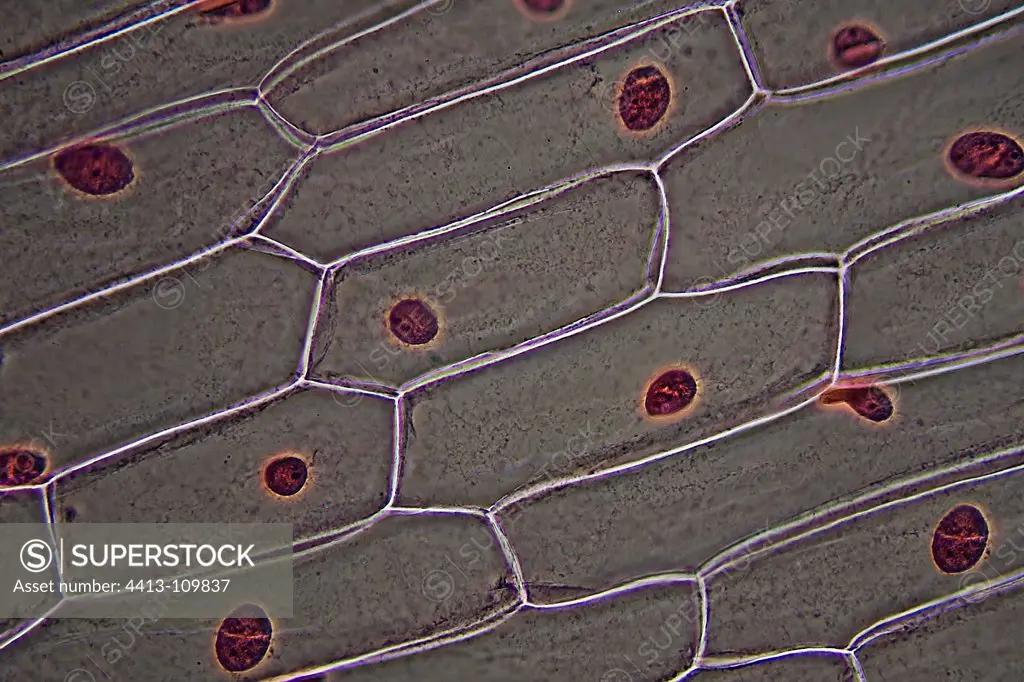 Microscopic view of skin Onion