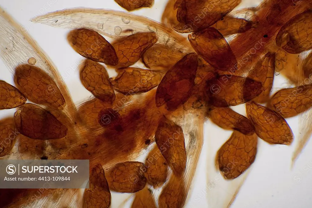 Microscopic view of Sporangia Bryum Moss