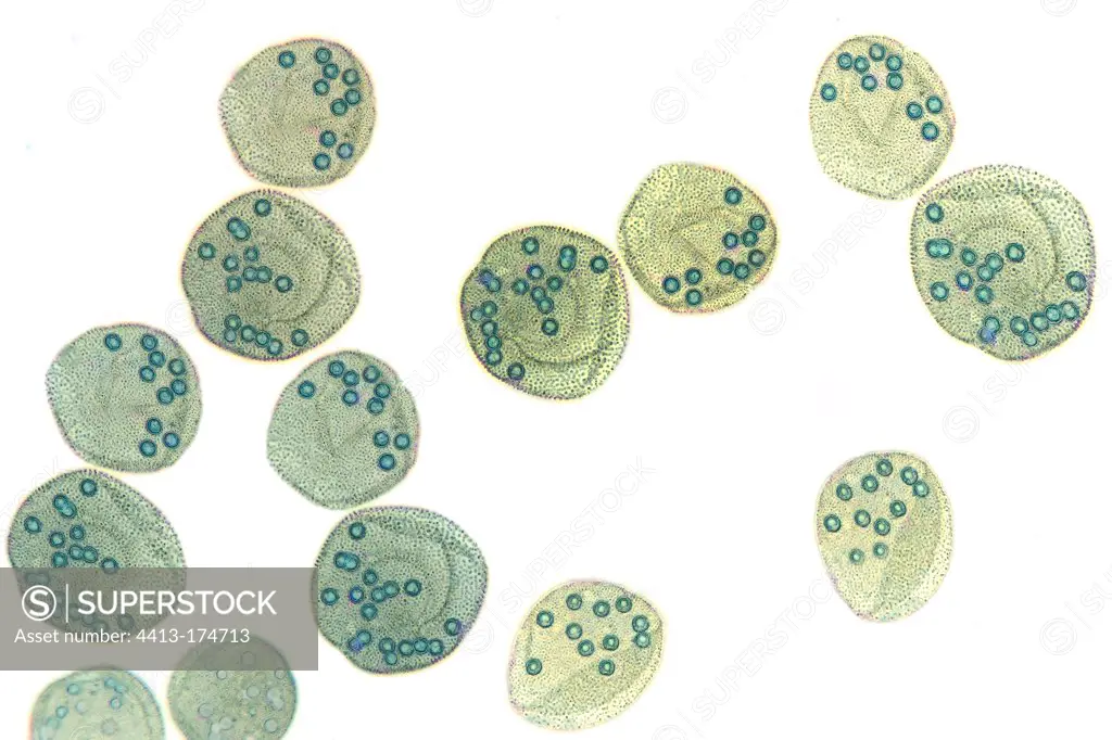 Colonies of Volvox algaes in light microscopy