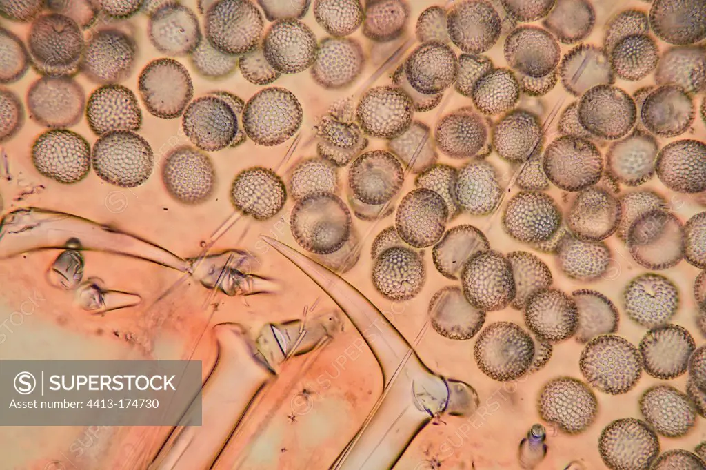 Transversal cut of a Sponge by light microscopy