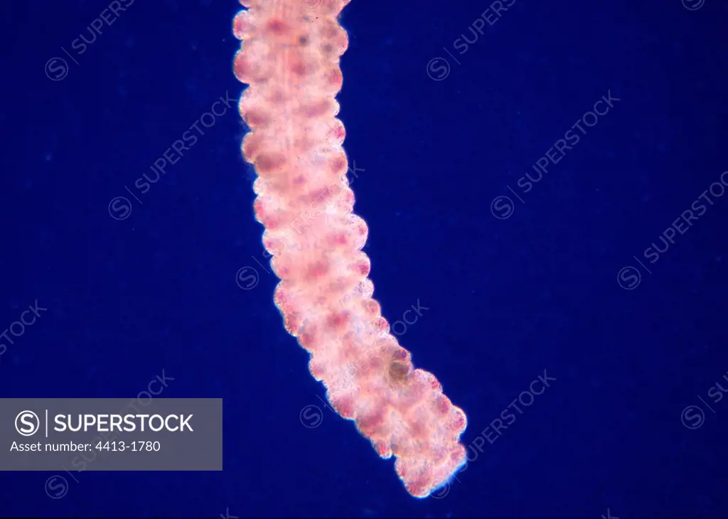 Detail of part of a Mauve Stinger Jellyfish tentacle