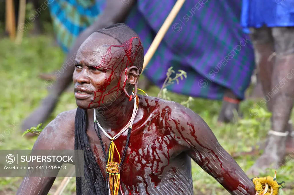 Bloodied Surma warrior after stick fighting Ethiopia