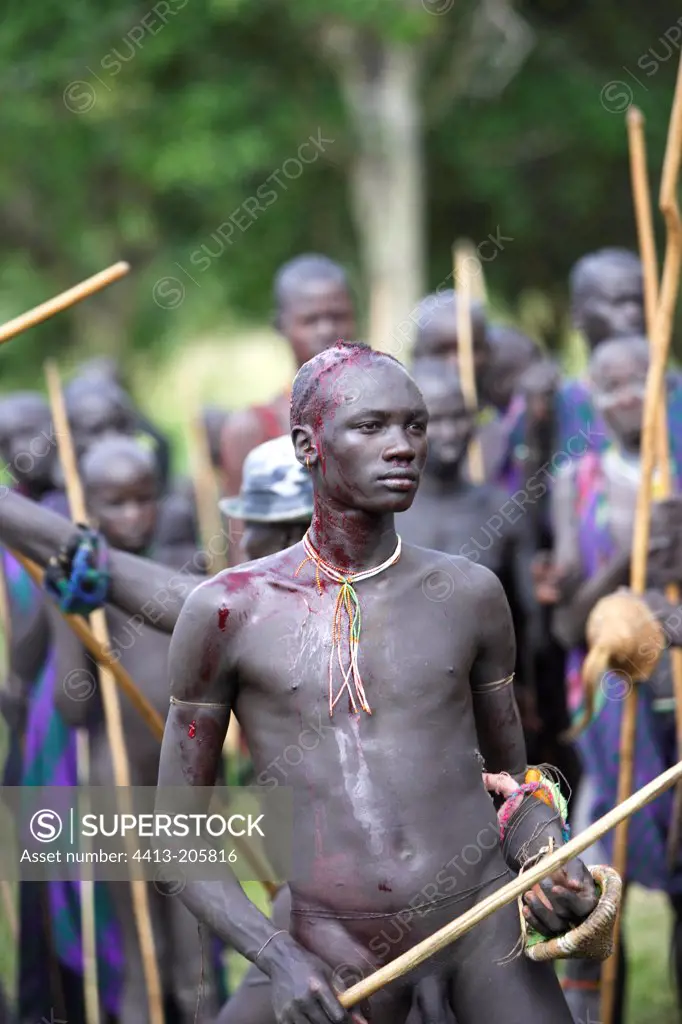 Bloodied Surma warrior during stick fighting Ethiopia