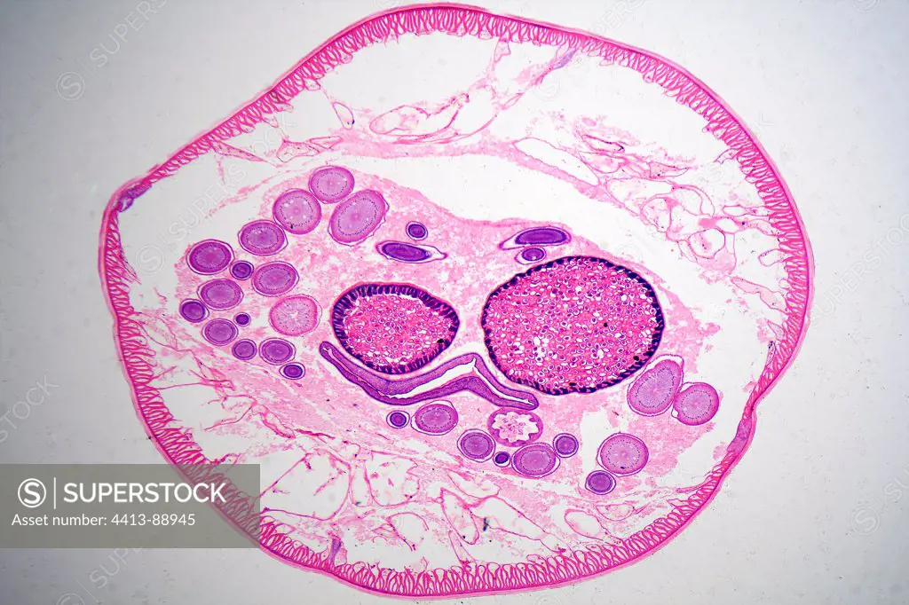 Cross section of Ascaris in the oviduct