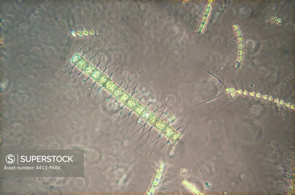 Diatoms Chaetoceros under the optical microscope
