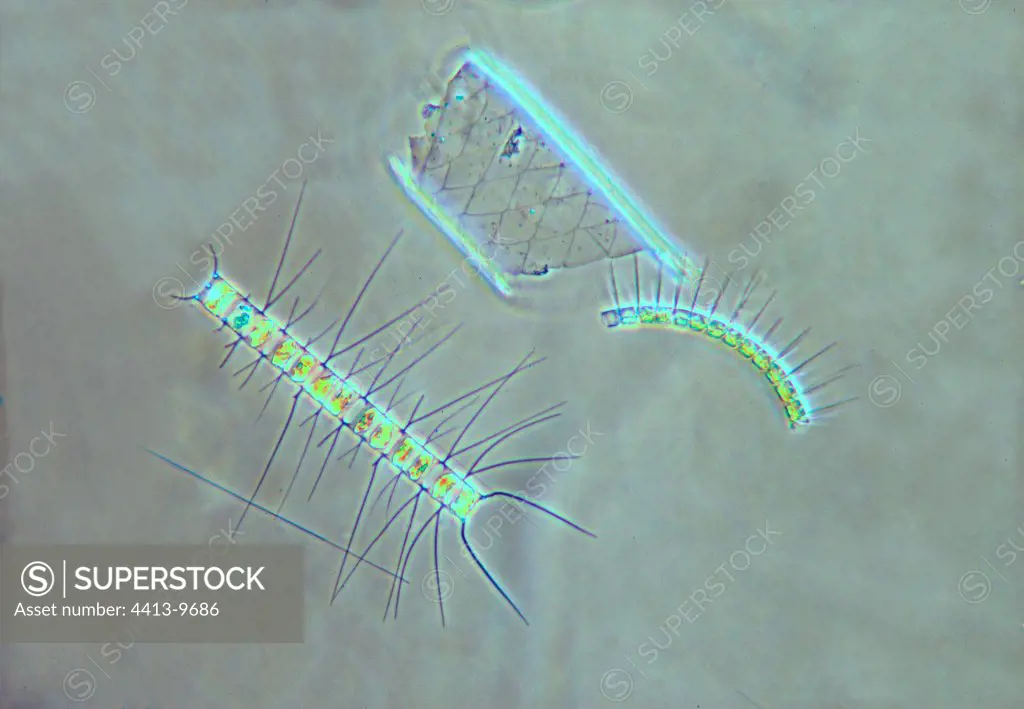 Diatoms Chaetoceros under the optical microscope
