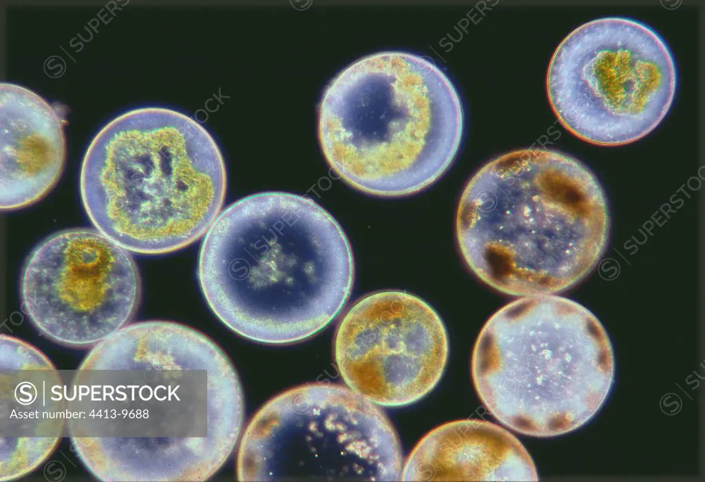 Diatoms Coscinodiscus under the optical microscope