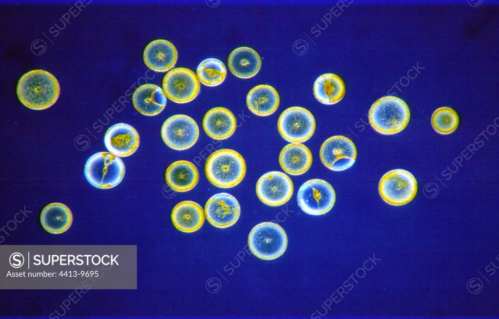 Diatoms Coscinodiscus under the optical microscope