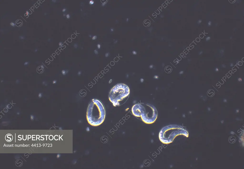 Ovocites of the Nematode parasite of European Eels