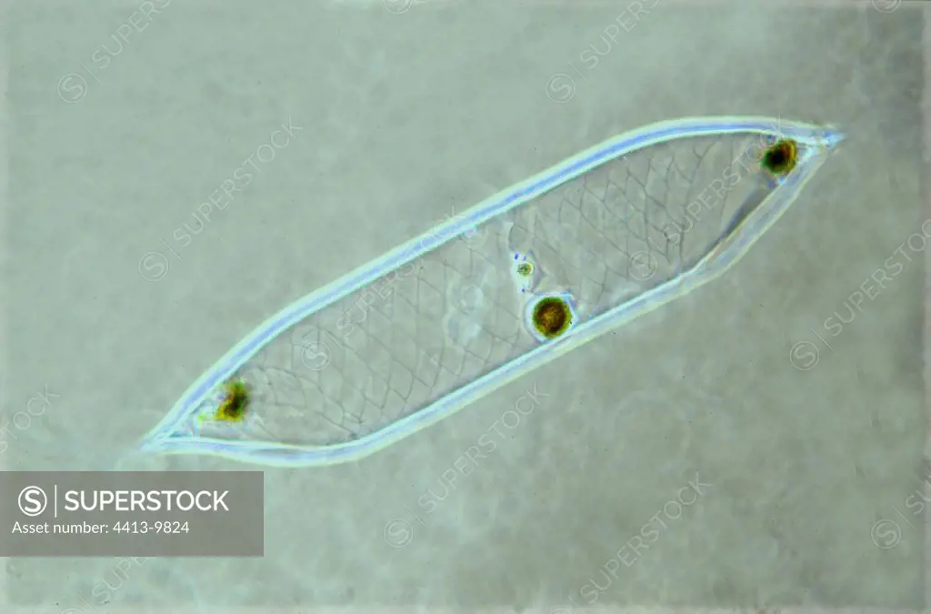 Diatom in optical microscopy