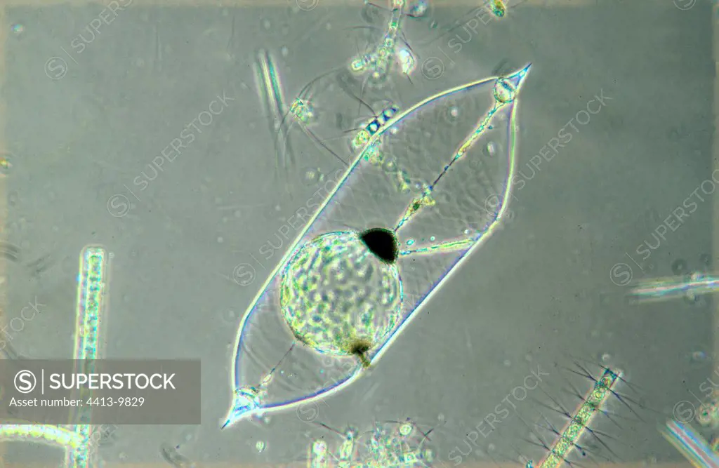 Diatom in optical microscopy