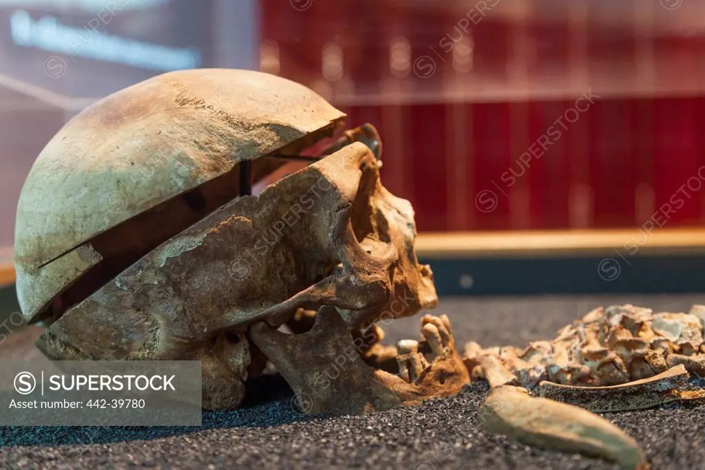 UK, England, London, Dissected Skull from Royal London Hospital Cemetery