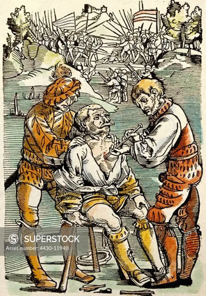 medicine treatment military surgeon treating mercenary wounded by an arrow woodcut from ""Feldtbuch der Wundartzney"" by Hans von Gersdorff Strasbourg Germany 1528,