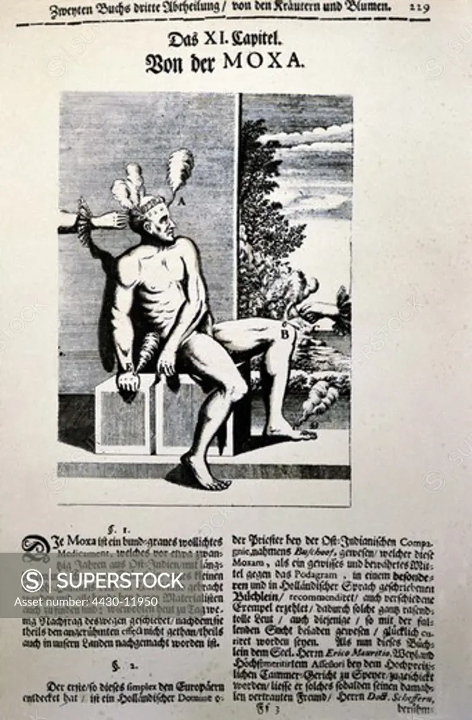 medicine treatment moxibustion illustration from ""Museum museorum"" by Michael Bernhard Valentini Fankfurt on the Main Germany 1714 private collection,