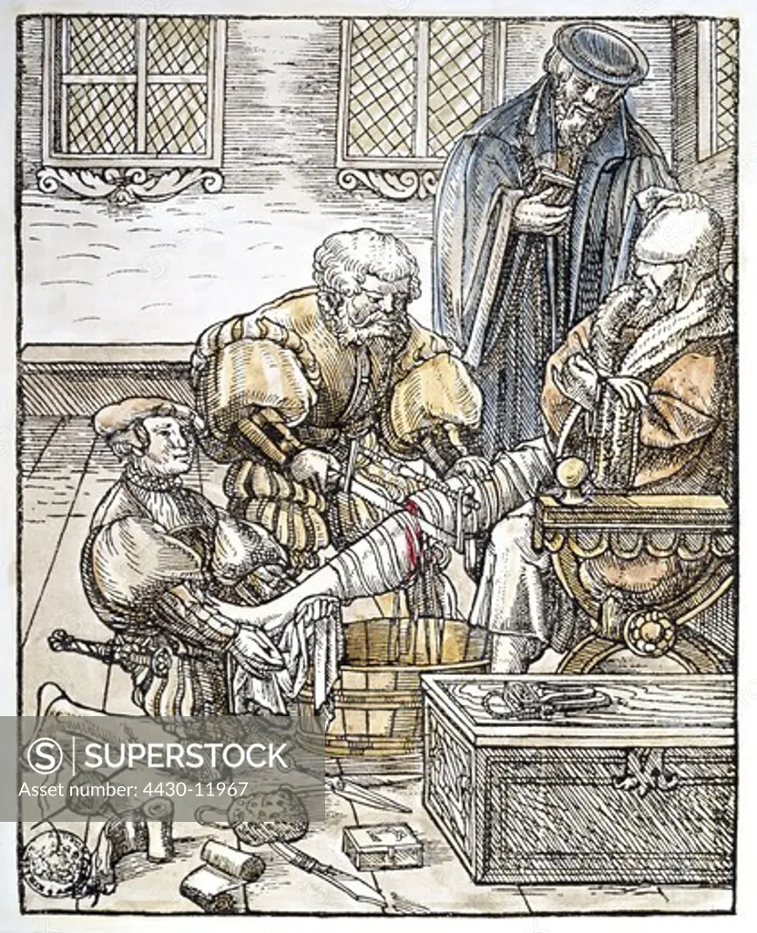 medicine surgery amputation of the lower leg woodcut coloured Nuremberg Germany circa 1530 private collection,