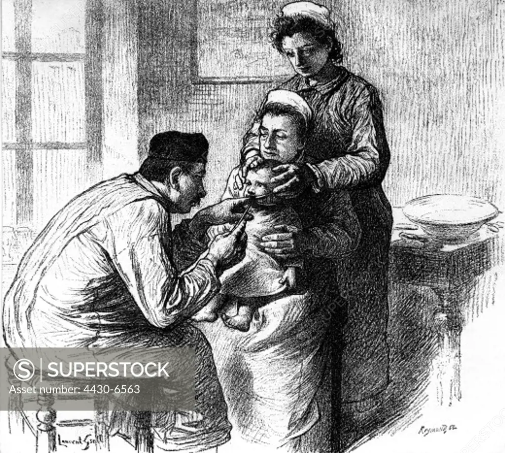 medicine diseases diphtheria treatment surgery intubation method by O'Dwyer since 1885 children's hospital Paris drawing by Laurent Gsell 19th century,