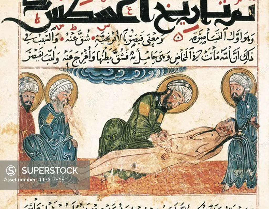 Al-Biruni Manuscript. Folio 161, 16r with a cesarean illustration. Islamic art. Miniature Painting. UNITED KINGDOM. SCOTLAND. EDINBURGH. Edinburgh. Edinburgh University Library.