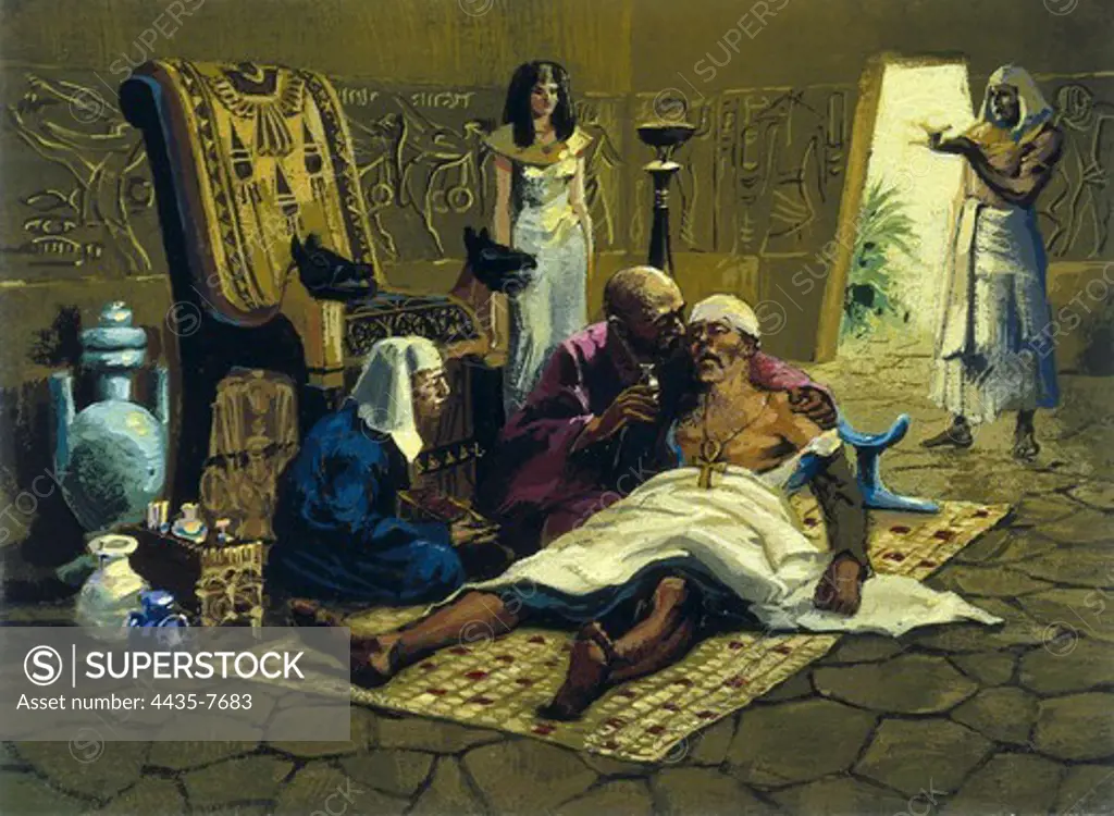 Representation of a trepanation in Ancient Egypt. Painting.