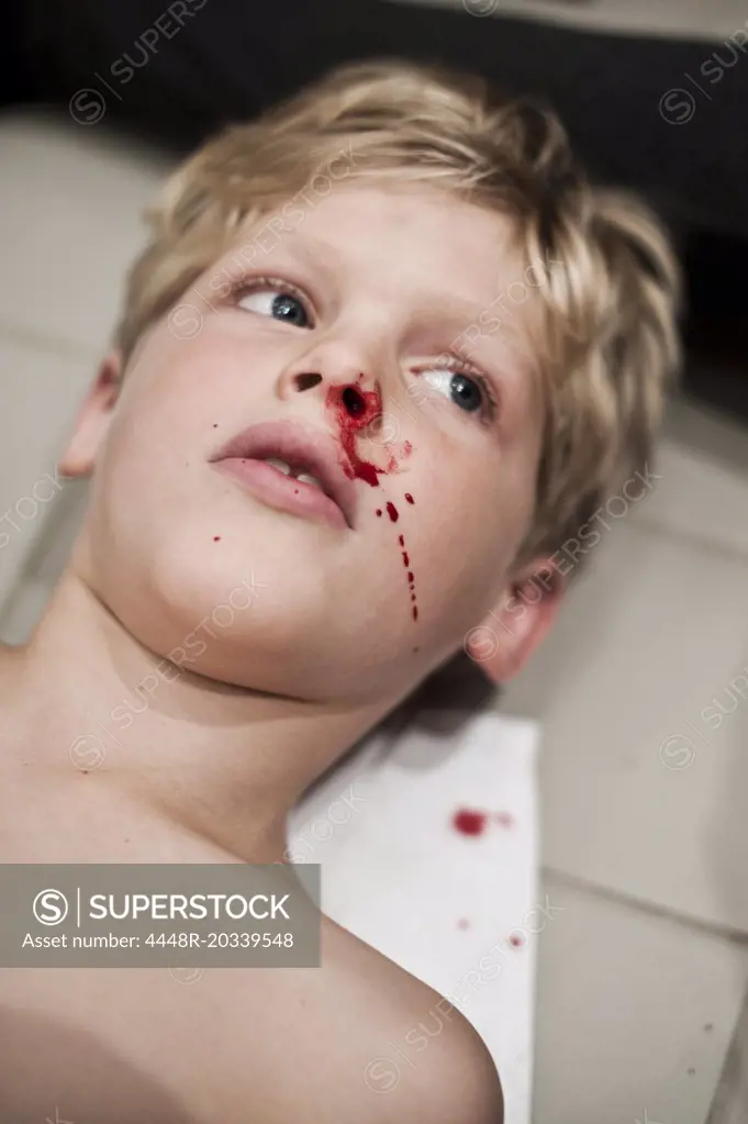 Elementary boy with bleeding nose looking away