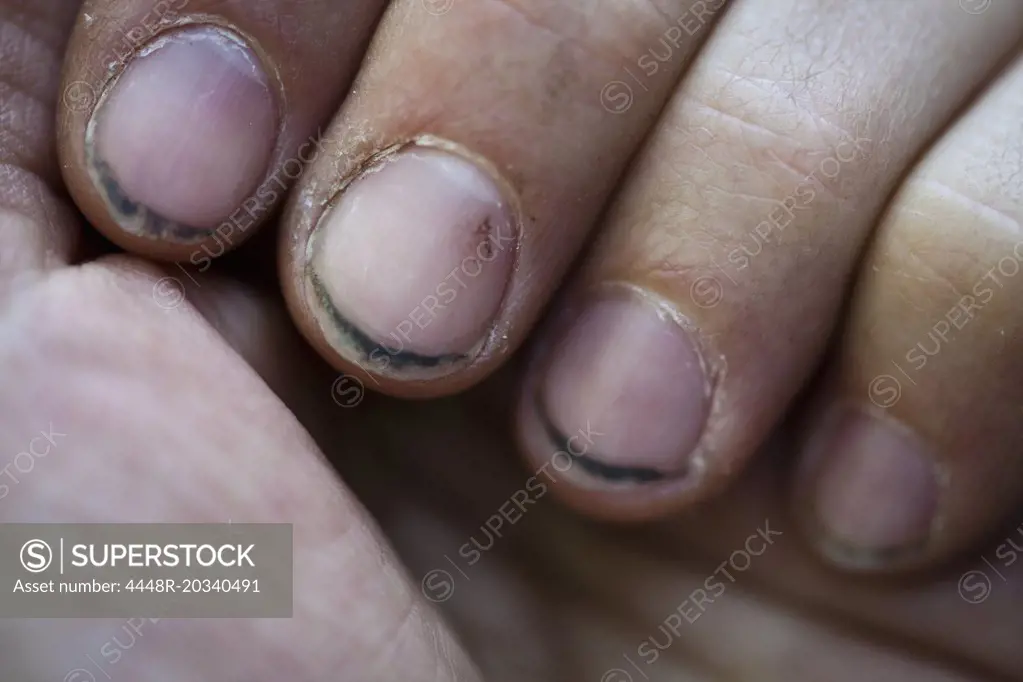 Close-up of hand with dirty fingernails