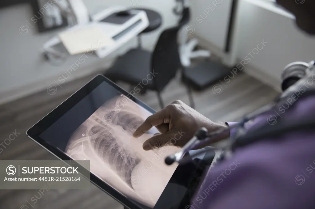 Male doctor viewing digital chest x-ray on digital tablet in clinic examination room