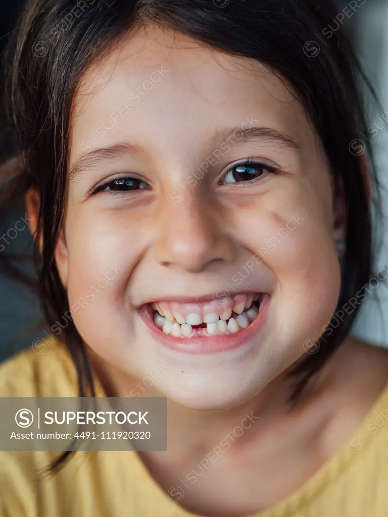 Happy child without tooth looking at camera and cheerfully smiling