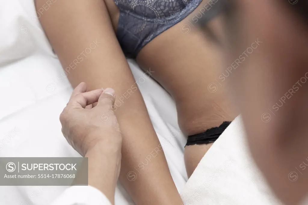 a doctor doing acupuncture sticks a needle into a patient's forearm