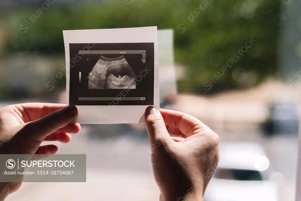Woman's hands holding an ultrasound of her baby.