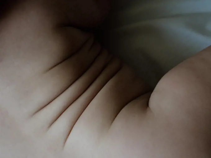 folds on the skin of a baby girl