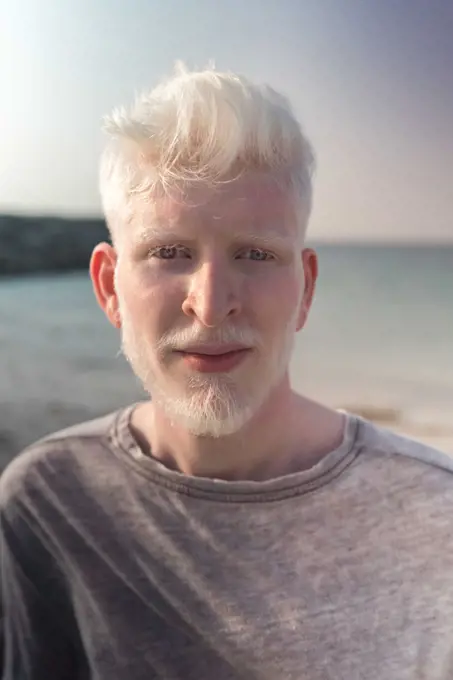 Albino man portrait by the beach looking at the camera