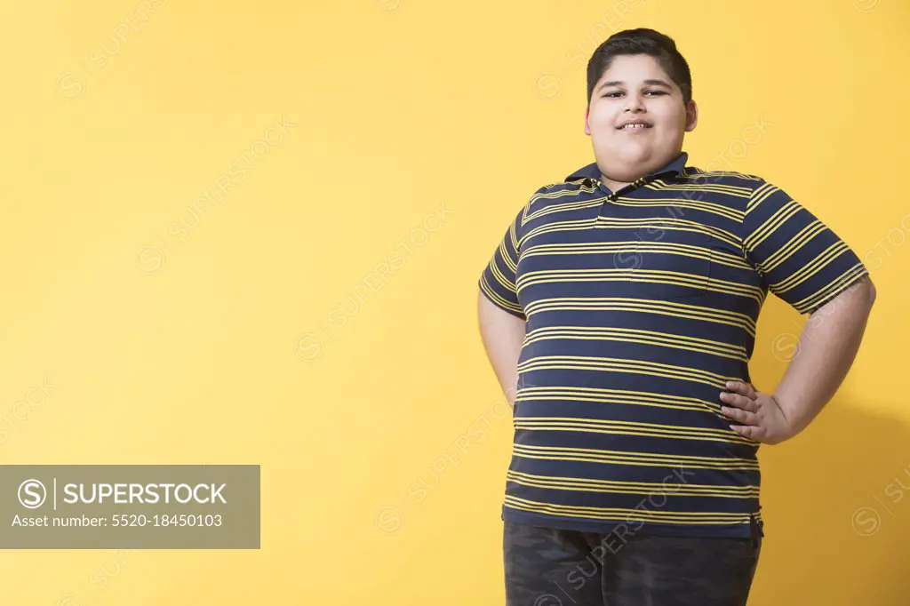 Obese boy standing and posing. (Obesity)