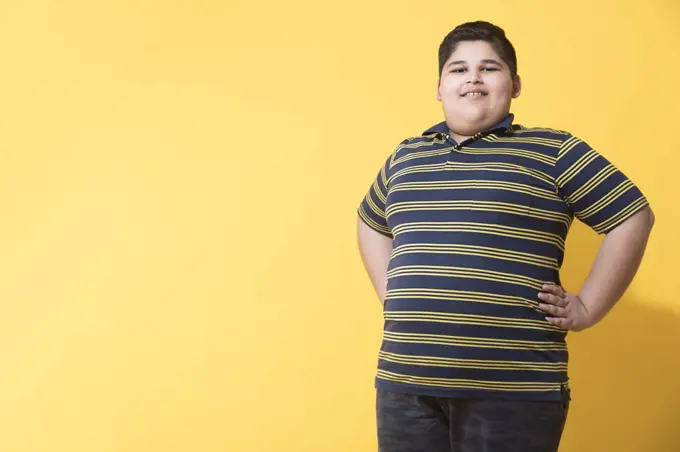 Obese boy standing and posing. (Obesity)