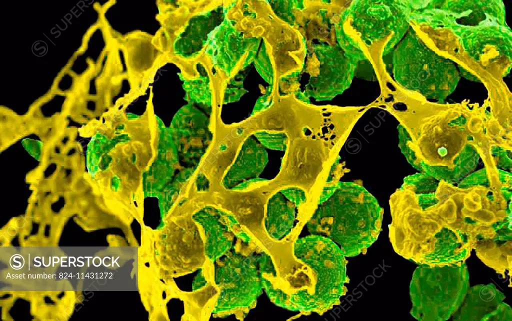 Scanning electron micrograph of methicillin-resistant Staphylococcus aureus (MRSA, green) surrounded by cellular debris. MRSA resists treatment with m...