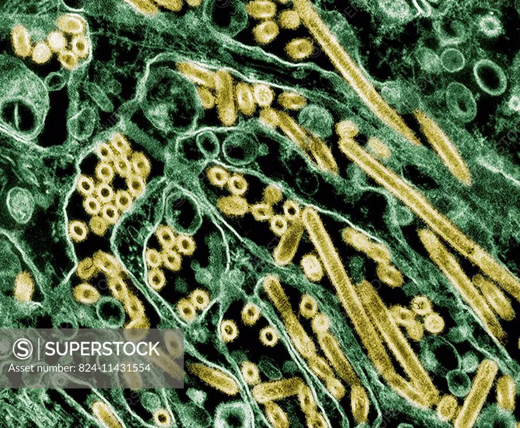 Colorized transmission electron micrograph of Avian influenza A H5N1 viruses grown in MDCK cells. Avian influenza A viruses do not usually infect huma...