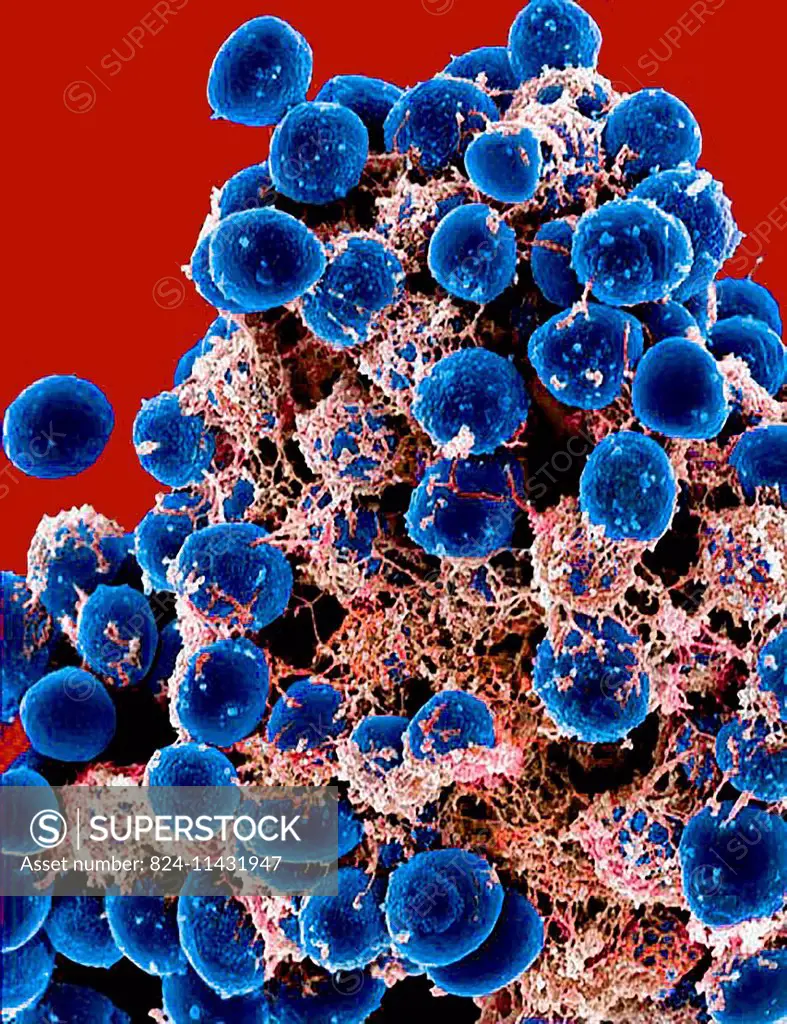 Scanning electron micrograph of a clump of Staphylococcus epidermidis bacteria in the extracellular matrix, which connects cells and tissue.