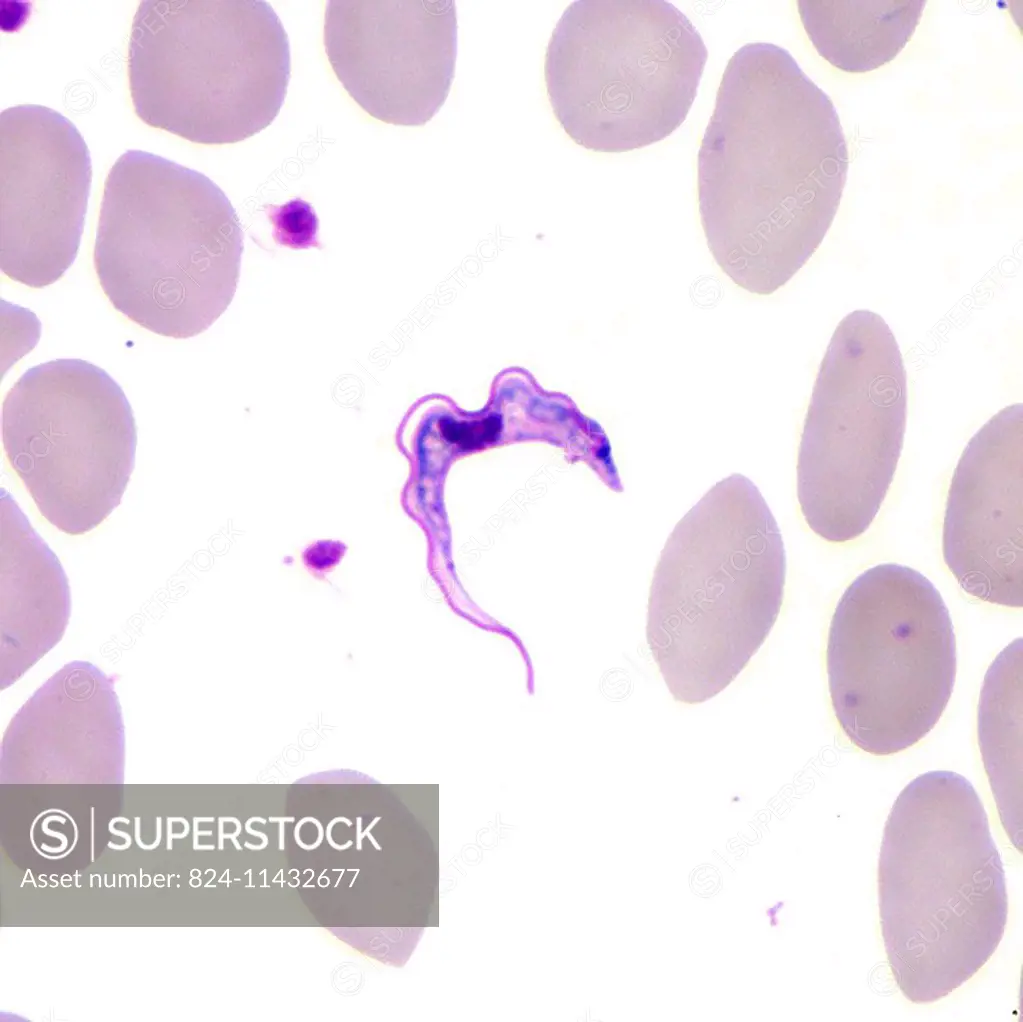 This Giemsa-stained light photomicrograph revealed the presence of two Trypanosoma brucei parasites, which were found in a blood smear. Humans are the...