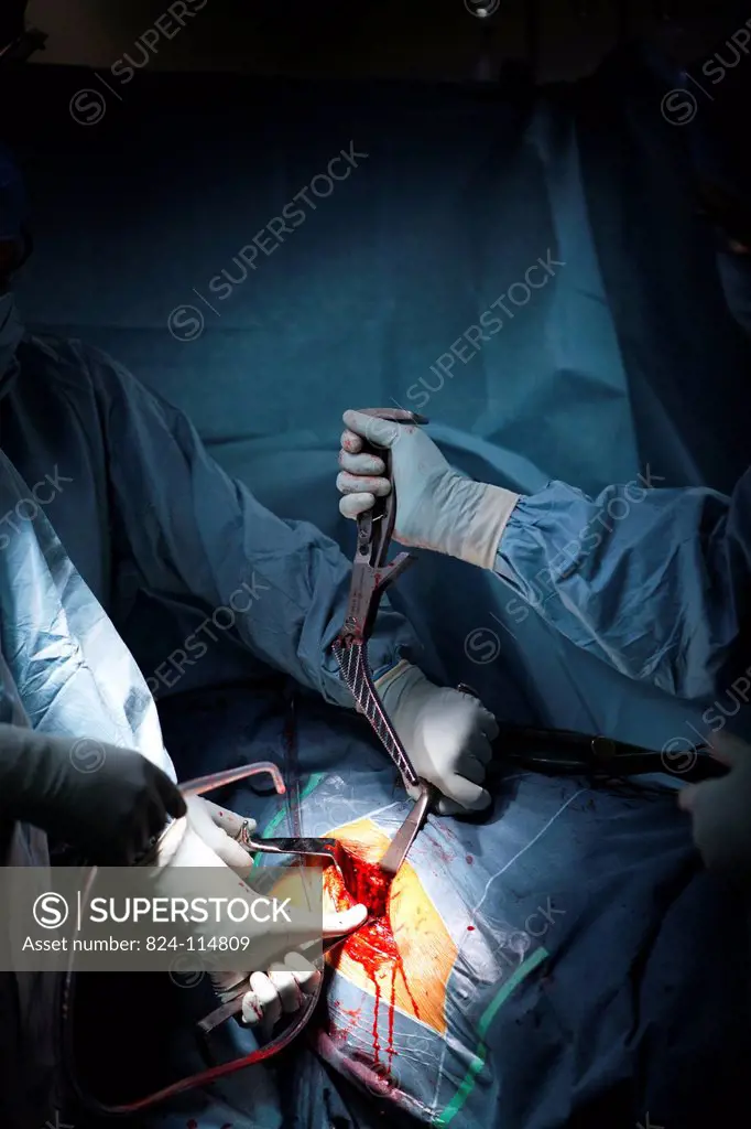 Reportage in the orthopaedic surgery unit in the Diaconesses Croix Saint Simon hospital in Paris. Placing a second hip prosthesis.