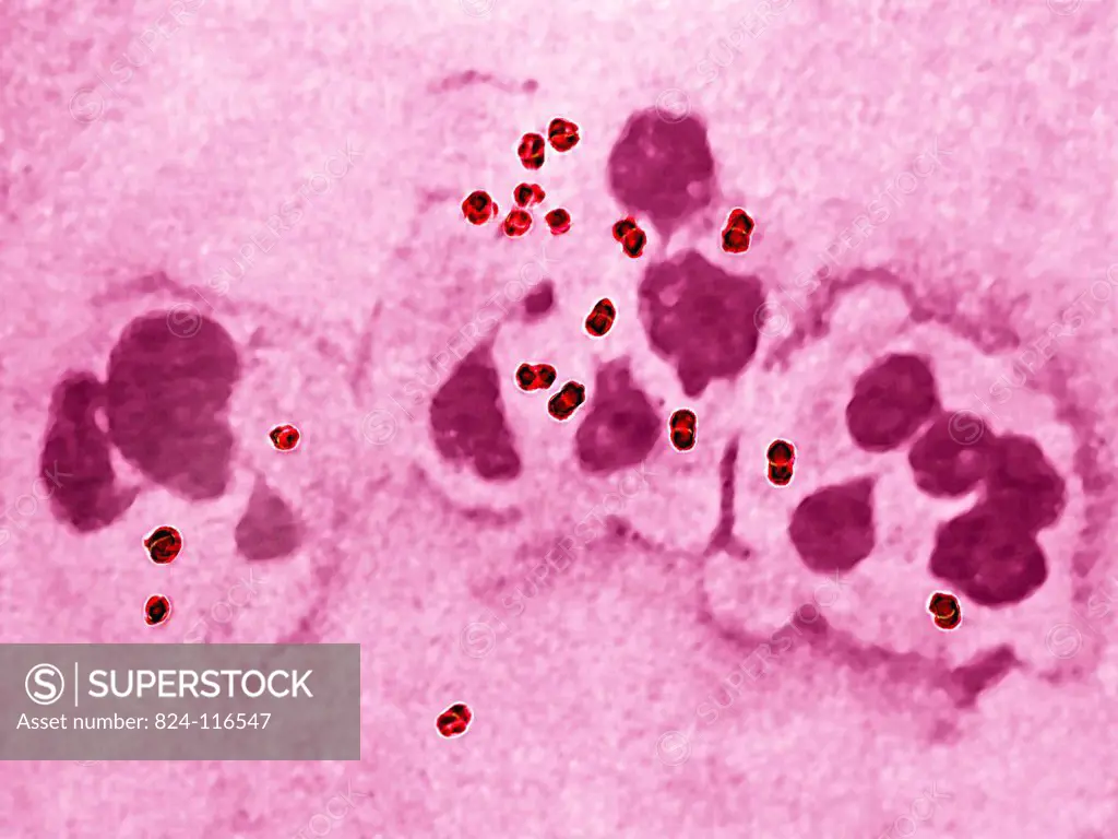 Meningococcus or Neisseria meningitidis, is a bacterium that can cause meningitis. The bacteria are germs that can be found in the rhinopharynx, where...