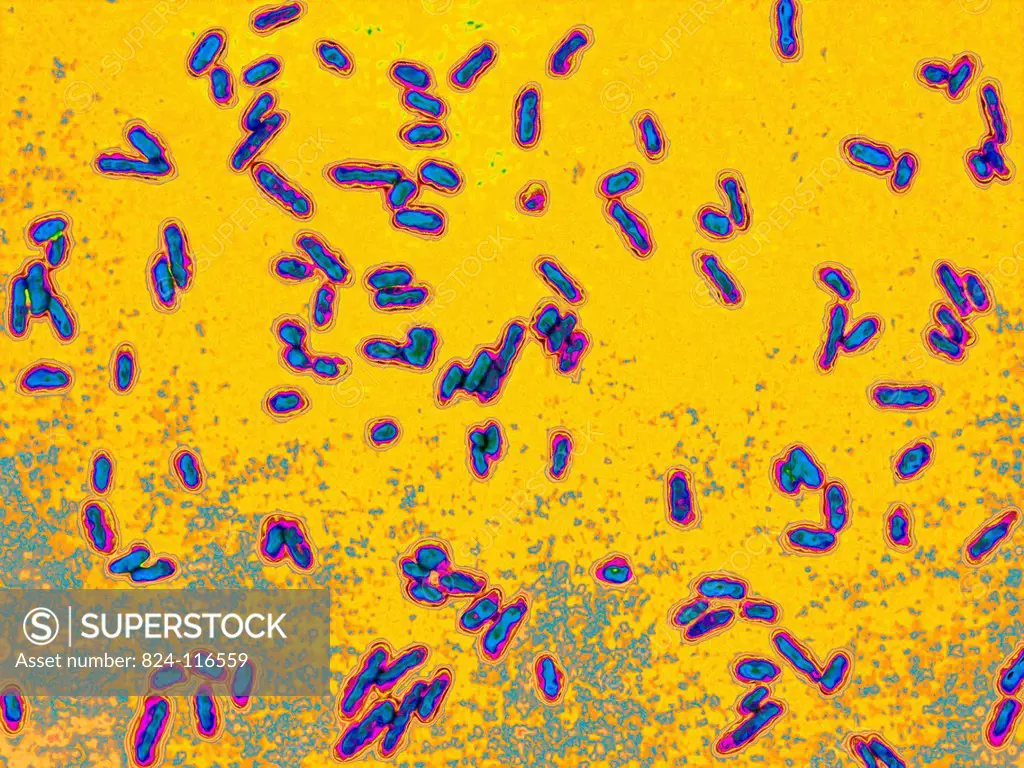 Dysentery bacillus shigella. This bacterium causes shigellosis, an infectious colitis characterised by an acute inflammatory reaction in the intestine...