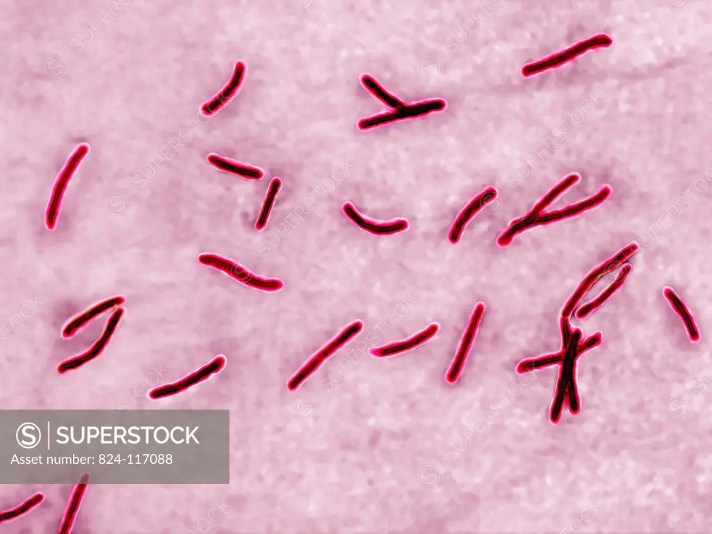 Mycobacterium tuberculosis or Koch´s bacillus is the causative agent for tuberculosis. Tuberculosis is making a come back due to the appearance of mul...