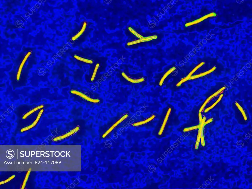 Mycobacterium tuberculosis or Koch´s bacillus is the causative agent for tuberculosis. Tuberculosis is making a come back due to the appearance of mul...