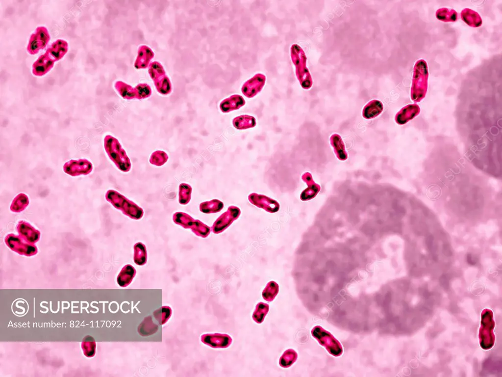 Yersinia pestis Pasteurella pestis is the bacterium responsible for the bubonic plague. Optical microscopy x 2000.