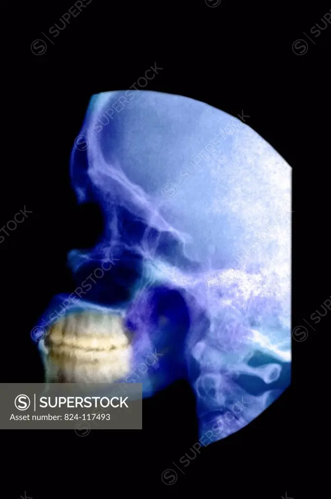X_ray of the sinuses of a 35_year old woman. No anomaly observed.