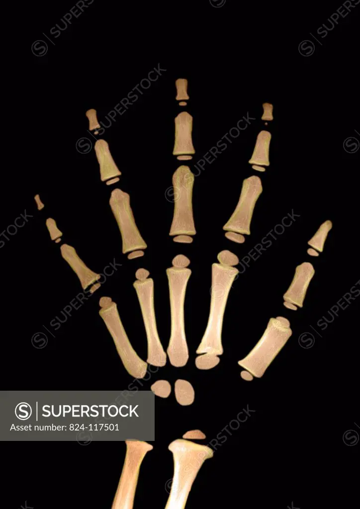 3 years old child radiography. Normal bone age