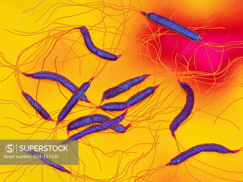 Helicobacter pylori is a bacterium that affects mucus in the stomach. 80 of gastric duodenal ulcers are caused by this bacterium. Helicobacter pylori ...