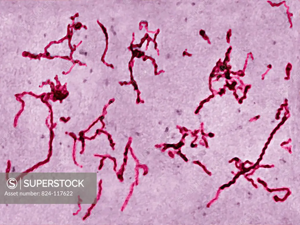 Leptospira interrogans, the bacterium responsible for Weil´s disease, the  most severe form of leptospirosis. Symptoms are hemorrhaging, acute renal  fa... - SuperStock