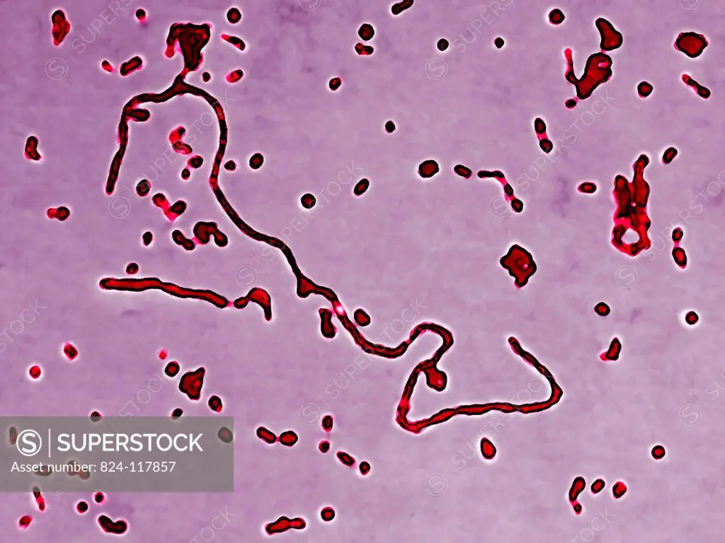 Haemophilus influenzae Pfeiffer´s bacillus. Its unencapsulated strain is responsible for local infections : ear infections, sinusitis, pharyngitis, co...
